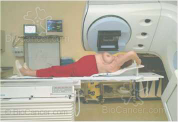 Principios generales del cáncer  Generalidades en oncología radioterápica (II)  Etapas Del Proceso Radioterápico Verificación Y Puesta En Marcha